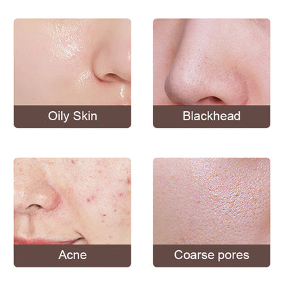 Ultrasonic Skin Scrubber – Deep Pore Cleanse & Exfoliate